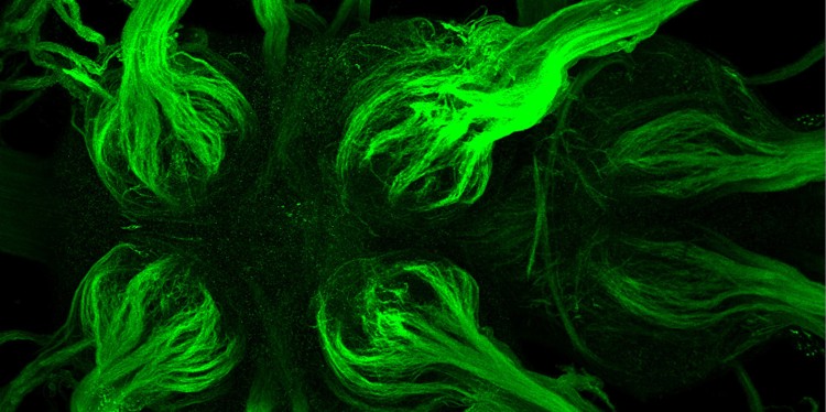 Microscopic view of the nervous system of an adult fruit fly. Green fluorescently-tagged channel proteins are shown on the axons of the neurons.<address>© WWU - AG Klämbt</address>