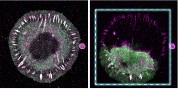The figure shows a connective tissue cell in which the adhesion protein talin has been modified. As long as no laser light with a suitable wavelength is switched on, the cell forms normal adhesion structures, which are important for attachment to the surrounding tissue (left). Irradiation with short laser pulses leads to a rupture of the talin connection, the importance of which immediately becomes clear: without intact talin connections, the cell can no longer hold on to the underlying substrate and collapses (right).<address>© AG Grashoff</address>