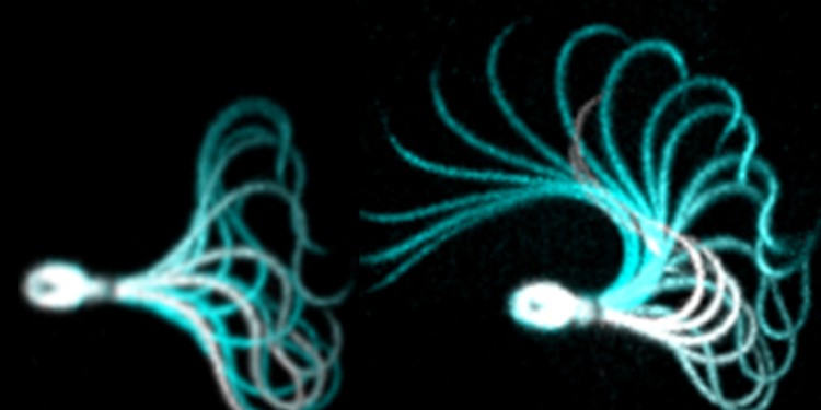 Beating pattern of a human sperm cell before (left) und after (right) activation of CatSper. The more powerful beat is required to fertilize the egg<address>© University of Münster / Strünker group</address>