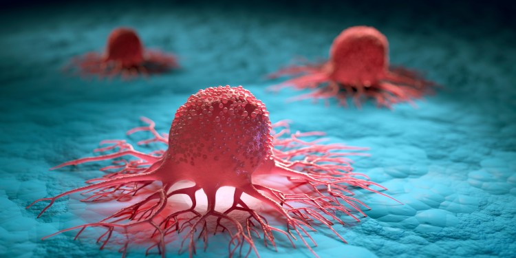 Illustration einer Gruppe von isolierten Krebszellen.<address>© peterschreiber.media - stock.adobe.com</address>