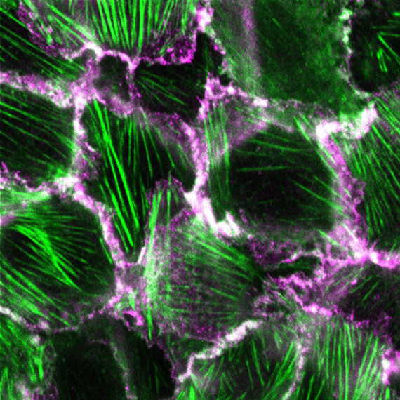 The image shows the skin epithelial cells used in the study, which originate from mice. The staining of the cells cultivated in the laboratory clearly shows that the cell-cell contacts (magenta) not only link the individual cells together, but also serve as anchor points for the cytoskeleton (actin cytoskeleton, green).<address>© Lukas Windgasse und Carsten Grashoff</address>