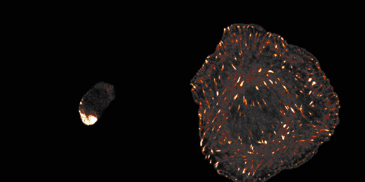 Microscopic image: amoebae (left), animal cell (right). In both cells, the talin protein can be seen fluorescing red and white. The background of the image is dark.<address>© AG Grashoff</address>