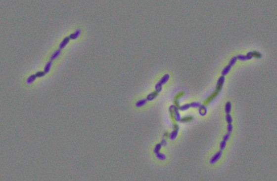 Bakterien der Art Acetobacterium dehalogenans unter dem Mikroskop<address>&copy; AG Kurth - Jasmin Bernhardt</address>