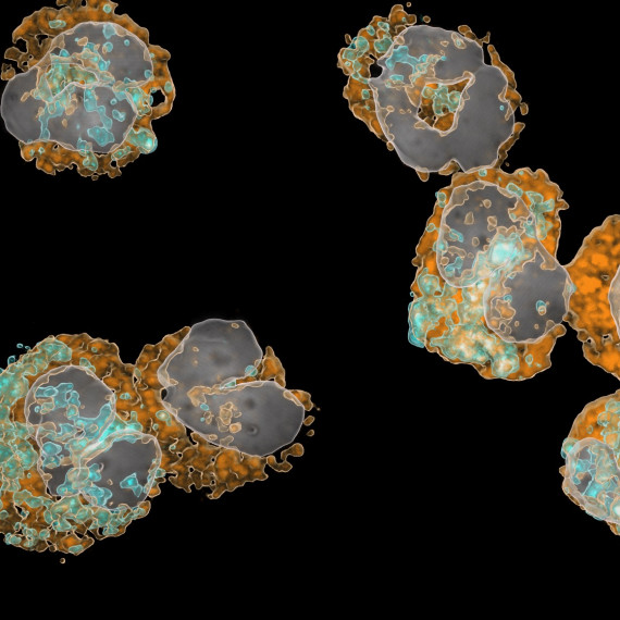 Mikroskopische Aufnahme mehrerer runder Immunzellen (neutrophile Granulozyten) im Blut. Die Zellkerne sind grau eingefärbt, zwei Oberflächenmerkmale orange und türkis. Eine unreife Vorläuferzelle fällt durch ihren gleichmäßig runden, grauen Zellkern auf.<address>&copy; Mathis Richter</address>