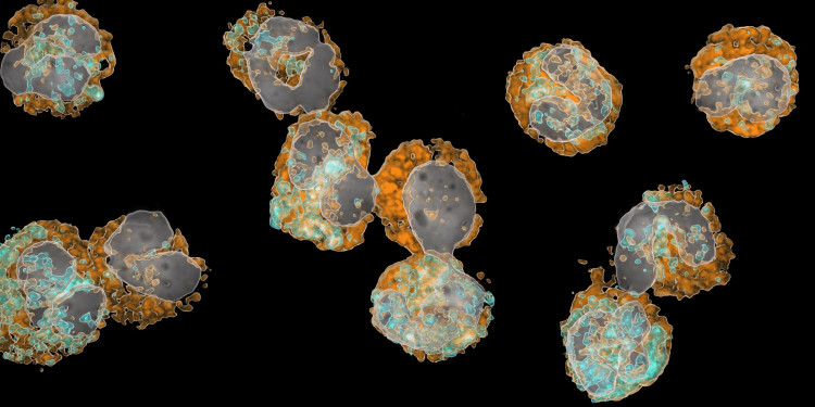 Mikroskopische Aufnahme mehrerer runder Immunzellen (neutrophile Granulozyten) im Blut. Die Zellkerne sind grau eingefärbt, zwei Oberflächenmerkmale orange und türkis. Eine unreife Vorläuferzelle fällt durch ihren gleichmäßig runden, grauen Zellkern auf.<address>&copy; Mathis Richter</address>